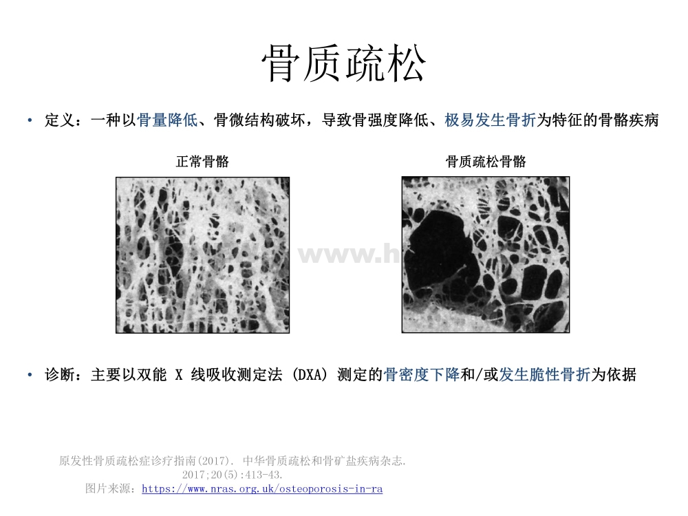 HIV/AIDS抗病毒治疗过程中的副作用监测和处理